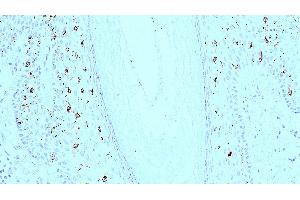 Human skin: immunohistochemical staining for langerin. (CD207 抗体)