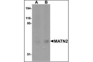 Western blot analysis of MATN2 in human liver tissue lysate with this product at (A) 1 and (B) 2 μg/ml. (MATN2 抗体  (C-Term))