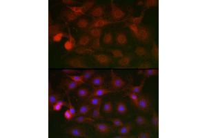 Immunofluorescence analysis of C6 cells using SSR2 Rabbit pAb (ABIN7270299) at dilution of 1:100 (40x lens). (SSR2 抗体)