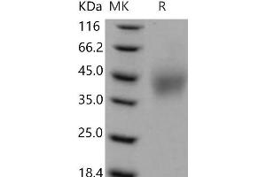 Western Blotting (WB) image for SLAM Family Member 6 (SLAMF6) (Active) protein (His tag) (ABIN7320336)