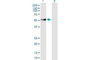 Western Blot analysis of ABAT expression in transfected 293T cell line by ABAT MaxPab polyclonal antibody. (ABAT 抗体  (AA 1-500))