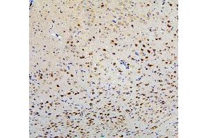IHC analysis of FACL4/ACSL4 using anti-FACL4/ACSL4 antibody (ABIN7602756).