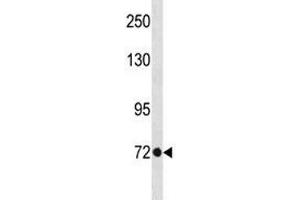 TBR2 antibody western blot analysis in A375 lysate. (EOMES 抗体  (AA 28-57))
