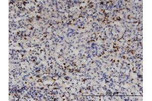 Immunoperoxidase of monoclonal antibody to HDAC4 on formalin-fixed paraffin-embedded human spleen. (HDAC4 抗体  (AA 551-648))