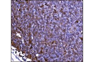 IHC analysis of FABP-1/GOT2 using anti-FABP-1/GOT2 antibody (ABIN7601426). (GOT2 抗体  (AA 35-430))