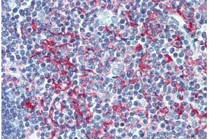 Human Thymus (formalin-fixed, paraffin-embedded) stained with LSP1 antibody ABIN305891 at 1:100 followed by biotinylated goat anti-rabbit IgG secondary antibody ABIN481713, alkaline phosphatase-streptavidin and chromogen. (LSP1 抗体  (AA 37-48))