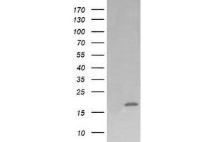 Image no. 5 for anti-Cancer/testis Antigen 1B (CTAG1B) antibody (ABIN1499906) (CTAG1B 抗体)