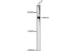 Western blot analysis of extracts of C2C12 cells, using MYH4 antibody (ABIN7268749) at 1:1000 dilution. (MYH4 抗体  (AA 1450-1550))