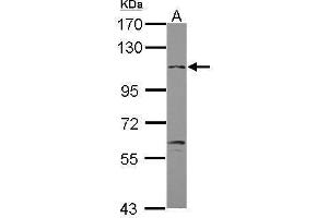 WB Image Sample (30 ug of whole cell lysate) A: U87-MG 7. (GABBR2 抗体)