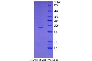 SDS-PAGE (SDS) image for ADAM Metallopeptidase with Thrombospondin Type 1 Motif, 2 (Adamts2) protein (ABIN3008054)