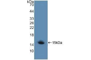Detection of Recombinant LRP1, Human using Polyclonal Antibody to Low Density Lipoprotein Receptor Related Protein 1 (LRP1) (LRP1 抗体  (AA 4441-4544))