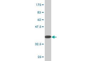 Western Blot detection against Immunogen (36. (ZBTB16 抗体  (AA 381-480))