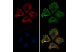 ABIN7094204 and ABIN7098250 staining HepG2 cells by IF/ICC.