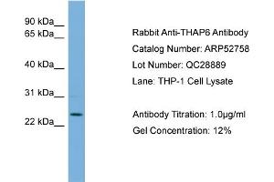 WB Suggested Anti-THAP6  Antibody Titration: 0. (THAP6 抗体  (Middle Region))