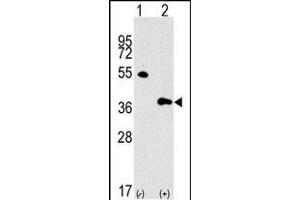 Western blot analysis of GBL Antibody (Center) polyclonal antibody (ABIN392823 and ABIN2842254) (arrow). (GBL 抗体  (AA 140-170))