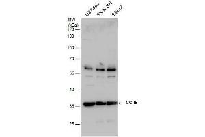 WB Image CCR5 antibody detects CCR5 protein by western blot analysis. (CCR5 抗体  (Center))