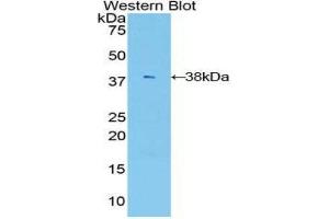 Western Blotting (WB) image for anti-V-Akt Murine Thymoma Viral Oncogene Homolog 3 (Protein Kinase B, Gamma) (AKT3) (AA 46-338) antibody (ABIN1860234) (AKT3 抗体  (AA 46-338))