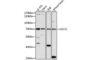 Western blot analysis of extracts of various cell lines, using SOCS5 antibody. (SOCS5 抗体)