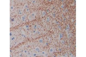IHC-P analysis of Human Tissue, with DAB staining. (SLC1A6 抗体  (AA 156-264))