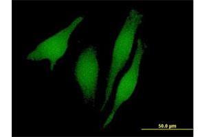 Immunofluorescence of purified MaxPab antibody to RUSC1 on HeLa cell. (RUSC1 抗体  (AA 1-433))