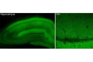Indirect immunostaining of PFA fixed hippocampus section (dilution 1 : 500). (CACNA1B 抗体  (AA 1921-2222))