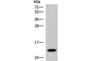 Western blot analysis of Human placenta tissue lysate using HBE1 Polyclonal Antibody at dilution of 1:300 (Hemoglobin, epsilon 1 (HBe1) 抗体)