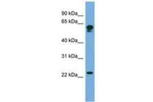 Image no. 1 for anti-Chromosome 14 Open Reading Frame 126 (C14orf126) (AA 71-120) antibody (ABIN6745654) (C14orf126 抗体  (AA 71-120))