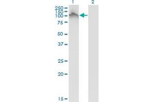 Western Blot analysis of FGFR2 expression in transfected 293T cell line by FGFR2 monoclonal antibody (M01), clone 1G3.