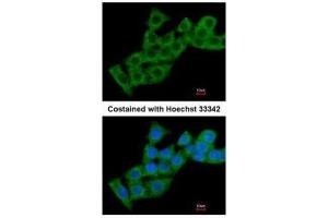 ICC/IF Image Immunofluorescence analysis of methanol-fixed HepG2, using Calcium binding protein P22, antibody at 1:200 dilution. (CHP 抗体  (Internal Region))