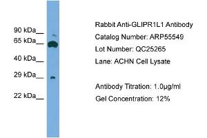 WB Suggested Anti-GLIPR1L1  Antibody Titration: 0. (GLIPR1L1 抗体  (Middle Region))