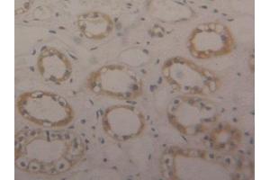 Used in DAB staining on fromalin fixed paraffin-embedded Kidney tissue (ENO1 抗体  (AA 1-434))