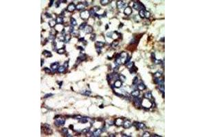 Image no. 1 for anti-NIMA-Related Kinase 1 (NEK1) (AA 1173-1202), (C-Term) antibody (ABIN360536) (NEK1 抗体  (C-Term))