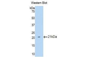 Western Blotting (WB) image for anti-Interleukin 12 Receptor, beta 2 (IL12RB2) (AA 455-606) antibody (ABIN3207279) (IL12RB2 抗体  (AA 455-606))