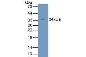 Detection of Recombinant UCP4, Human using Polyclonal Antibody to Uncoupling Protein 4, Mitochondrial (UCP4) (SLC25A27 抗体  (AA 21-317))