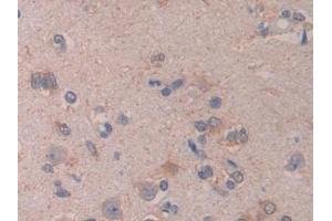 Immunohistochemistry (IHC) image for anti-Cross-Linked C-Telopeptides of Type I Collagen (CTX-I) antibody (ABIN7427822)