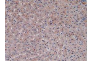 IHC-P analysis of Human Liver Tissue, with DAB staining. (ALT 抗体  (AA 581-738))