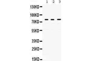 Western Blotting (WB) image for anti-Polymerase (DNA Directed), eta (POLH) (AA 157-361) antibody (ABIN3042492) (POLH 抗体  (AA 157-361))