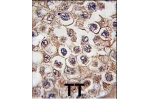 Formalin-fixed and paraffin-embedded human testis tissue reacted with INSRR antibody (N-term), which was peroxidase-conjugated to the secondary antibody, followed by DAB staining. (Insulin Receptor 抗体  (N-Term))