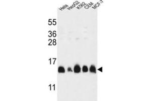 Western Blotting (WB) image for anti-Histone Cluster 1, H2al (HIST1H2AL) antibody (ABIN3002161) (HIST1H2AL 抗体)