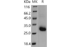 Western Blotting (WB) image for TIMP Metallopeptidase Inhibitor 1 (TIMP1) (Active) protein (ABIN7198251) (TIMP1 蛋白)