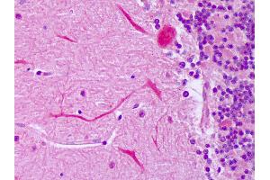 Anti-IGF2 antibody IHC of human brain, cerebellum, Purkinje.
