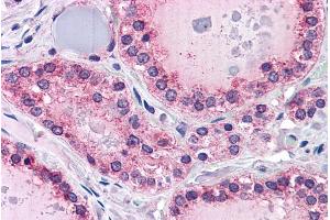Immunohistochemistry (IHC) image for anti-Protein Tyrosine Phosphatase, Receptor Type, M (PTPRM) (Internal Region) antibody (ABIN238629)