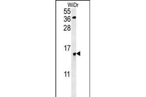 C19orf50 Antibody (Center) (ABIN653085 and ABIN2842681) western blot analysis in WiDr cell line lysates (35 μg/lane). (C19orf50 抗体  (AA 59-85))