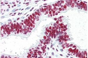 Human Uterus (Formalin-Fized, Paraffin-Embedded) stained with ACIN1 antibody ABIN461879 at 5 ug/ml followed by biotinylated goat anti-rabbit IgG secondary antibody ABIN481713, alkaline phosphatase-streptavidin and chromogen. (ACIN1 抗体)