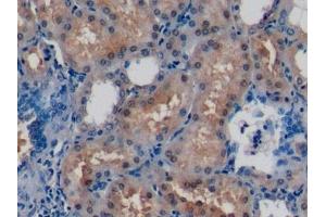 Detection of DUSP3 in Human Kidney Tissue using Polyclonal Antibody to Dual Specificity Phosphatase 3 (DUSP3) (Dual Specificity Phosphatase 3 (DUSP3) (AA 2-185) 抗体)