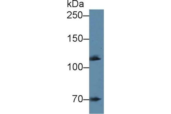 alpha Adducin antibody  (AA 388-560)