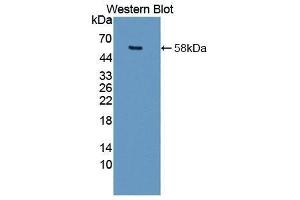 Western Blotting (WB) image for anti-Matrix Metallopeptidase 15 (Membrane-inserted) (MMP15) (AA 280-497) antibody (ABIN1862908) (MMP15 抗体  (AA 280-497))