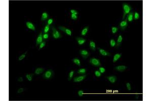 Immunofluorescence of monoclonal antibody to USF2 on HeLa cell. (USF2 抗体  (AA 1-100))