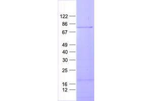 Western Blotting (WB) image for RIO Kinase 2 (RIOK2) protein (His tag) (ABIN2712360)