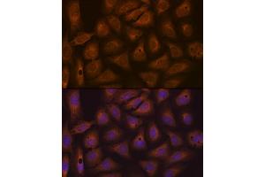 Immunofluorescence analysis of U-2 OS cells using CAD Rabbit mAb (ABIN7266064) at dilution of 1:100 (40x lens). (CAD 抗体)